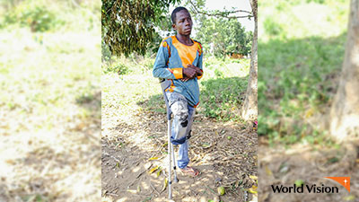한쪽 다리를 잃은 중앙아프리카공화국 소년. 사진